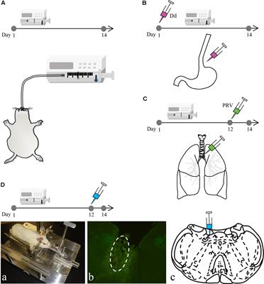 Dorsal Vagal Complex Modulates Neurogenic Airway Inflammation in a Guinea Pig Model With Esophageal Perfusion of HCl